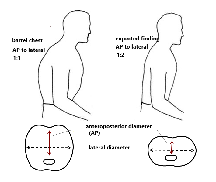 Focused Assessment Respiratory System Health Assessment Guide for Nurses