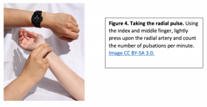 Taking a radial pulse